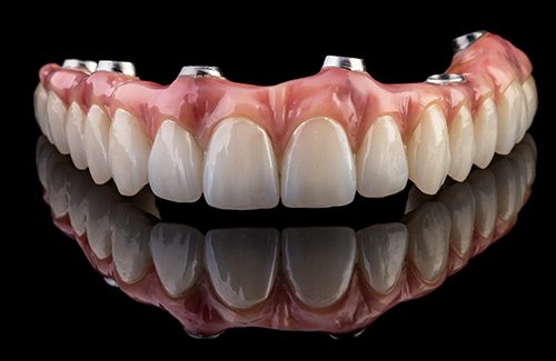 An implant denture in Glastonbury, CT