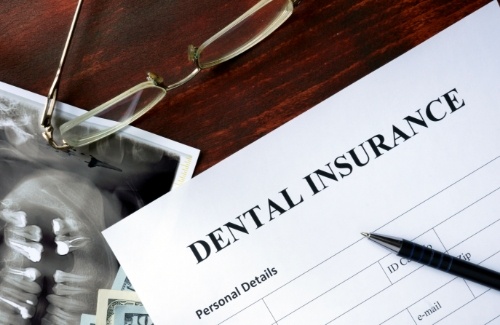 Dental insurance sitting on desk with dental x rays and glasses