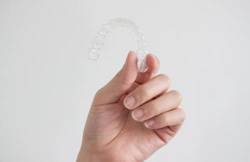 Multiple aligners for Invisalign in Glastonbury