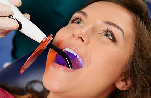 A young woman receiving tooth-colored fillings