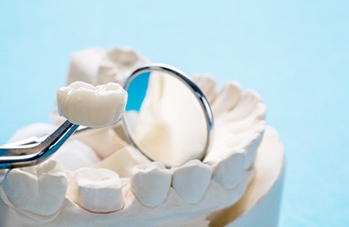 A closeup of a dental crown next to dental tools